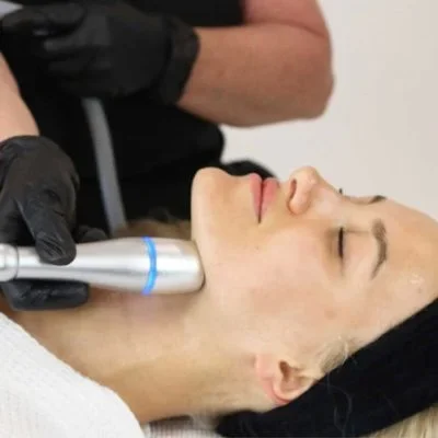 Add-On Facial CoolSculpting The Woodlands TX
